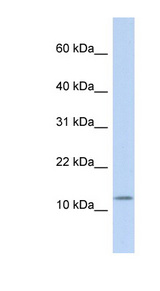 CCK / Cholecystokinin antibody LS-C101466 Western blot of Fetal Brain lysate.