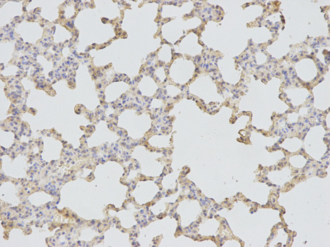 Immunohistochemistry of paraffin-embedded rat lung using CD46 antibody at dilution of 1:200 (200x lens).