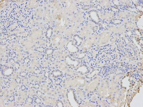 Immunohistochemistry of paraffin-embedded human kidney using CD46 antibody at dilution of 1:200 (200x lens).