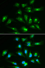 Immunofluorescence analysis of HepG2 cell using CD46 antibody. Blue: DAPI for nuclear staining.