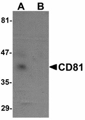 Western blot of CD81 in human lung tissue lysate with CD81 antibody at 1 ug/ml in (A) the absence and (B) the presence of blocking peptide. Below: Immunohistochemistry of CD81 in human lung tissue with CD81 antibody at 5 ug/ml.