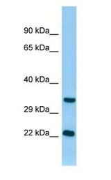 TNNI3 / CTnI antibody Western Blot of Rat Pancreas.