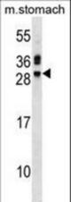 TNNI3 Antibody western blot of mouse stomach tissue lysates (35 ug/lane). The TNNI3 antibody detected the TNNI3 protein (arrow).