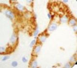 IHC of Ksp-Cadherin on FFPE Kidney tissue.