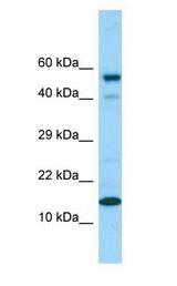 DOC-1 / CDK2AP1 antibody Western Blot of HeLa.
