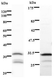 Western blot of immunized recombinant protein using CDK2AP1 antibody. Left: CDK2AP1 staining. Right: Coomassie Blue staining of immunized recombinant protein.