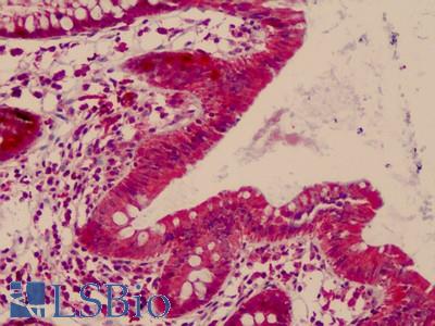 Human, Small Intestine: Formalin-Fixed Paraffin-Embedded (FFPE)