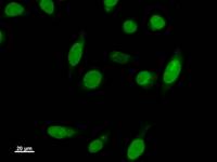 Immunostaining analysis in HeLa cells. HeLa cells were fixed with 4% paraformaldehyde and permeabilized with 0.1% Triton X-100 in PBS. The cells were immunostained with anti-CDK2AP mAb.