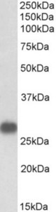 TNNI3 antibody (1 ug/ml) staining of Human Heart lysate (35 ug protein in RIPA buffer). Primary incubation was 1 hour. Detected by chemiluminescence.