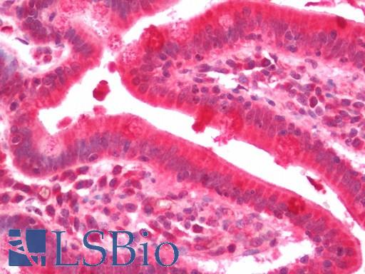 Human Small Intestine: Formalin-Fixed, Paraffin-Embedded (FFPE)