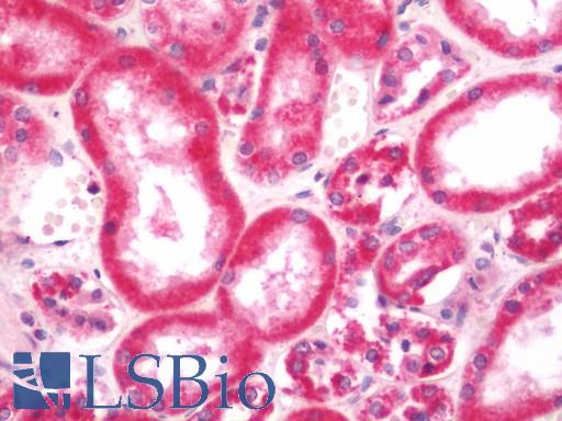 Human Kidney: Formalin-Fixed, Paraffin-Embedded (FFPE)