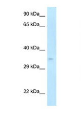 CDK5R1 / p35 antibody LS-C145910 Western blot of Mouse Pancreas lysate. Antibody concentration 1 ug/ml.