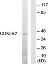Western blot of extracts from HUVEC cells, using CDK5R2 Antibody. The lane on the right is treated with the synthesized peptide.
