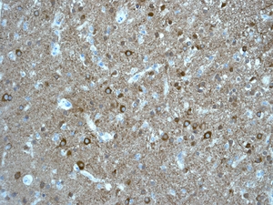 IHC of paraffin-embedded human brain tissue using anti-Cdk5R2antibody.