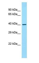 CDK5R2 / P39 antibody Western Blot of NCI-H226.