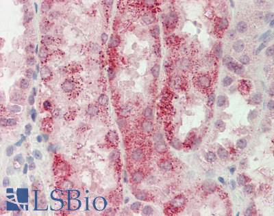 Human Kidney: Formalin-Fixed, Paraffin-Embedded (FFPE)