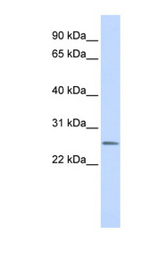 CEACAM4 antibody LS-C102162 Western blot of Fetal Lung lysate.