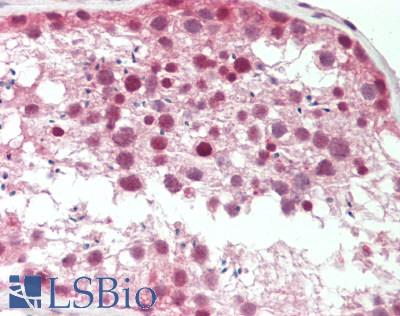 Human Testis: Formalin-Fixed, Paraffin-Embedded (FFPE)
