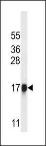 CELA1 Antibody western blot of A2058 cell line lysates (35 ug/lane). The CELA1 antibody detected the CELA1 protein (arrow).