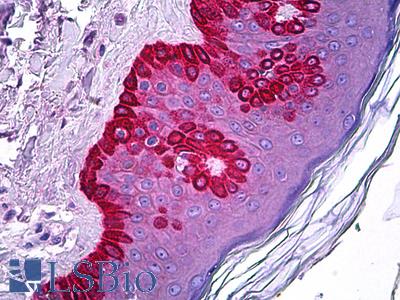 Anti-CELA1 antibody IHC of human skin. Immunohistochemistry of formalin-fixed, paraffin-embedded tissue after heat-induced antigen retrieval. Antibody LS-B5934 concentration 5 ug/ml.
