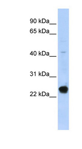 C16orf80 / GTL3 antibody LS-C101489 Western blot of HepG2 cell lysate.