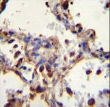 WDR52 Antibody immunohistochemistry of formalin-fixed and paraffin-embedded human lung tissue followed by peroxidase-conjugated secondary antibody and DAB staining.