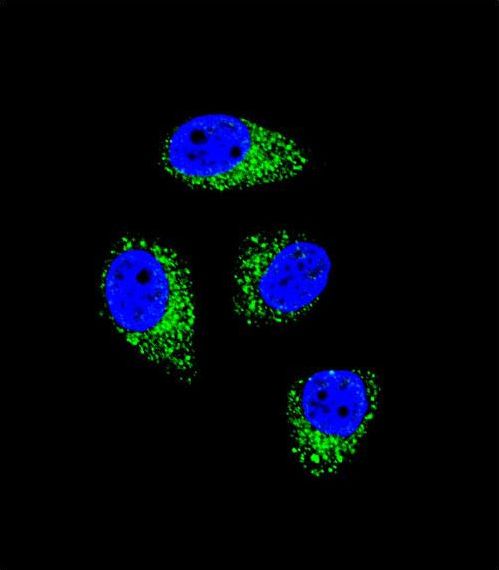 Confocal immunofluorescent of WDR52 Antibody with A549 cell followed by Alexa Fluor 488-conjugated goat anti-rabbit lgG (green). DAPI was used to stain the cell nuclear (blue).