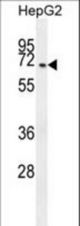 CCDC19 Antibody western blot of HepG2 cell line lysates (35 ug/lane). The CCDC19 antibody detected the CCDC19 protein (arrow).