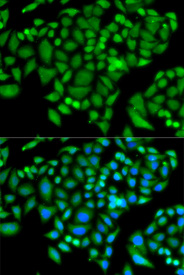 Immunofluorescence analysis of MCF-7 cell using CHAF1B antibody. Blue: DAPI for nuclear staining.