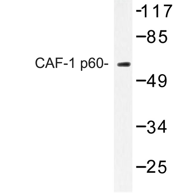 Western blot of CAF-1 p60 (W93) pAb in extracts from Jurkat cells.