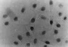 CAF-1 p60 Antibody (SS 24 1-68) - CAF-1 p60 (SS24 1-68) - Immunocytochemical staining of CAF-1 p60 in HeLa cells (Smith and Stillman 1991).