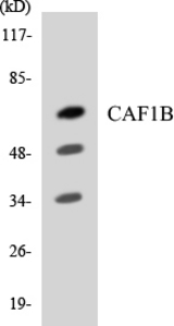 Western blot of the lysates from RAW264.7cells using CAF1B antibody.