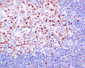 IHC of paraffin-embedded human tonsil tissue using anti-CAF-1 p60 antibody.