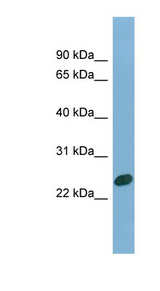 CHMP1B antibody LS-C112055 Western blot of Fetal Heart lysate.