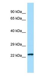 CHMP2B / DMT1 antibody Western Blot of Rat Spleen.