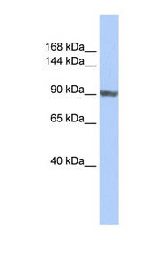 TNNI3K antibody LS-C102284 Western blot of HepG2 cell lysate.