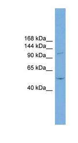 TNNI3K antibody LS-C116348 Western blot of Jurkat lysate.