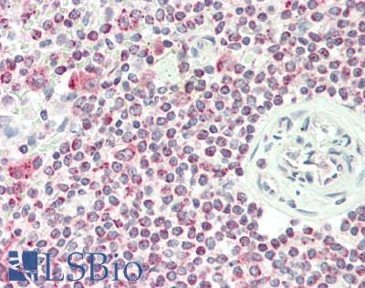 Human Spleen: Formalin-Fixed, Paraffin-Embedded (FFPE)