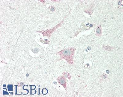 Human Brain, Cortex: Formalin-Fixed, Paraffin-Embedded (FFPE)