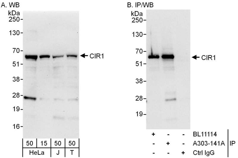 Detection of Human CIR1 by Western Blot and Immunoprecipitation. Samples: Whole cell lysate from HeLa (15 and 50 ug for WB; 1 mg for IP, 20% of IP loaded), Jurkat (J; 50 ug) and 293T (T; 50 ug) cells. Antibodies: Affinity purified rabbit anti-CIR1 antibody used for WB at 0.1 ug/ml (A) and 1 ug/ml (B) and used for IP at 6 ug/mg lysate. CIR1 was also immunoprecipitated by rabbit anti-CIR1 antibody BL11114, which recognizes an upstream epitope. Detection: Chemiluminescence with exposure times of 30 seconds (A) and 3 seconds (B).