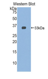 Western blot of recombinant TNNT1 / TNT.