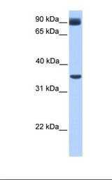 Fetal muscle lysate. Antibody concentration: 1.0 ug/ml. Gel concentration: 12%.