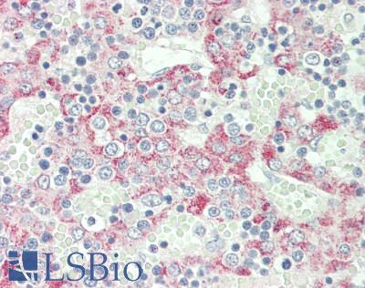 Human Liver: Formalin-Fixed, Paraffin-Embedded (FFPE)