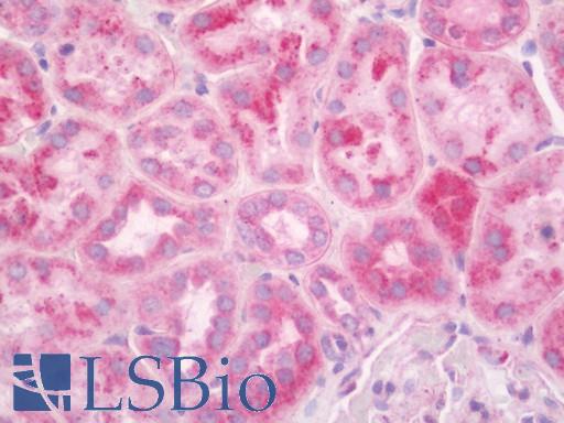 Human Kidney: Formalin-Fixed, Paraffin-Embedded (FFPE)