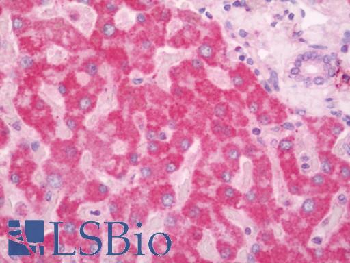 Human Liver: Formalin-Fixed, Paraffin-Embedded (FFPE)