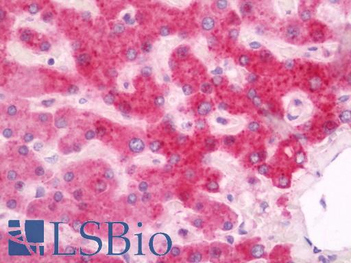 Anti-CNGB1 / GARP antibody IHC staining of human liver. Immunohistochemistry of formalin-fixed, paraffin-embedded tissue after heat-induced antigen retrieval. Antibody LS-B11368 concentration 20 ug/ml.