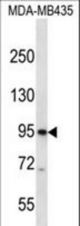 CNGB3 Antibody western blot of MDA-MB435 cell line lysates (35 ug/lane). The CNGB3 antibody detected the CNGB3 protein (arrow).