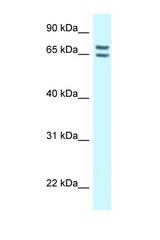 CNKSR1 antibody LS-C145941 Western blot of 8226 Cell lysate. Antibody concentration 1 ug/ml.