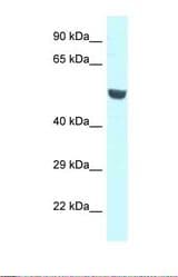 Western blot of Human A549 . CNKSR1 antibody dilution 1.0 ug/ml.