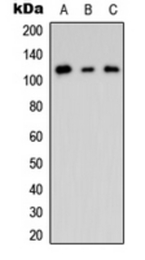Western blot analysis of CNK2 expression in HEK293T (A); mouse Brain (B); rat brain (C) whole cell lysates.